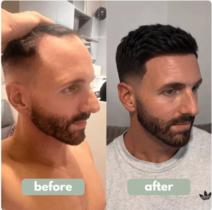Advanced Hair Growth Roll-on Serum